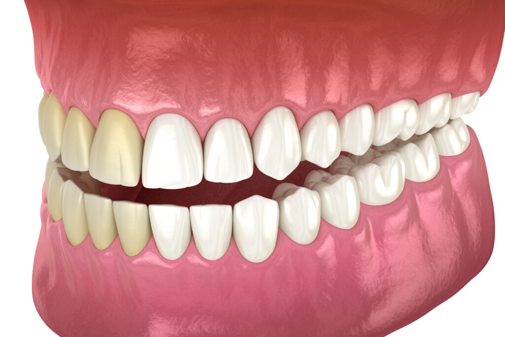 A bright, confident smile demonstrating the results of professional teeth whitening.